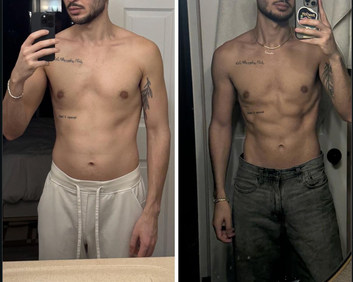 Retatrutide Before And After Real Results From The Community 2026 