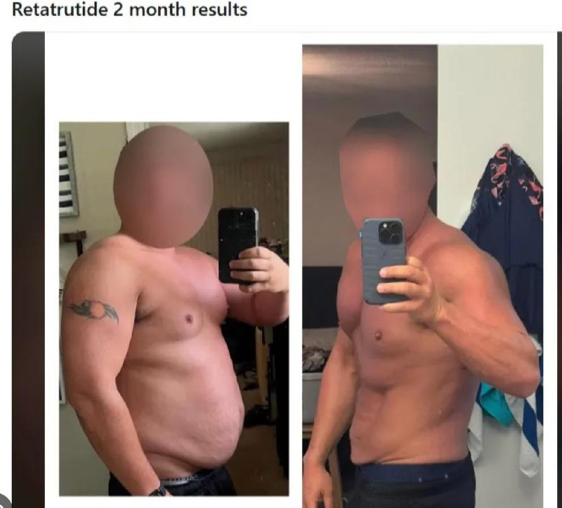 Retatrutide 2 month before and after results