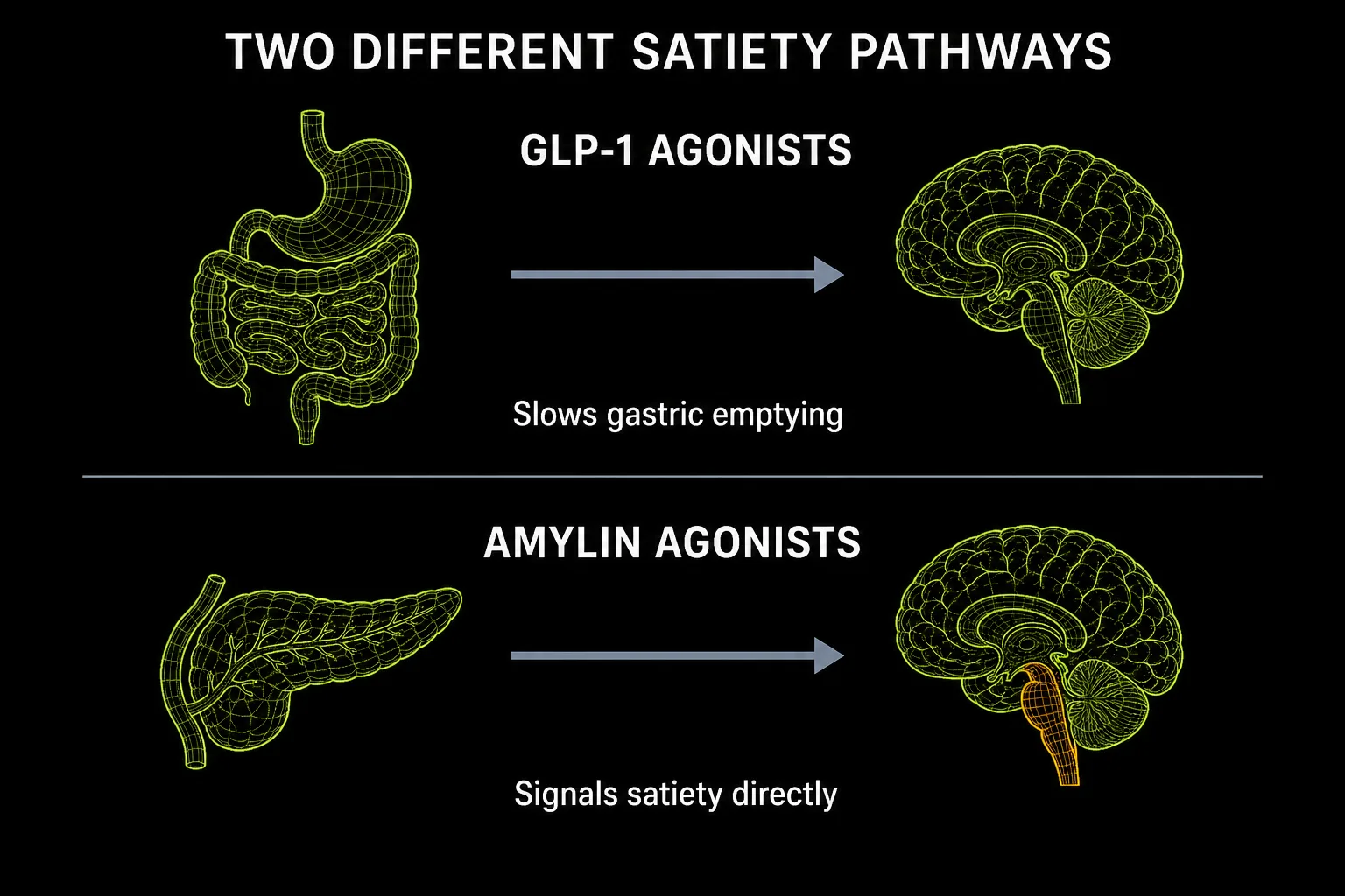 Diagram contrasting GLP-1 agonists acting via the gut to slow gastric emptying against amylin agonists signalling satiety directly through the brainstem